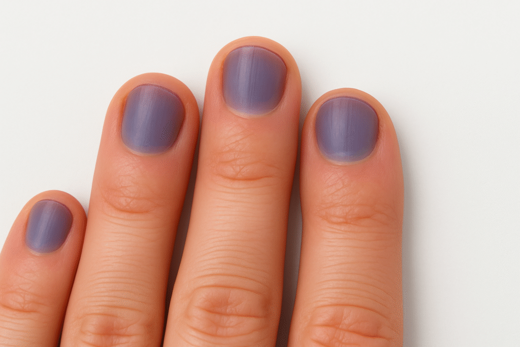 Why Are My Finger Nails Turning Purple